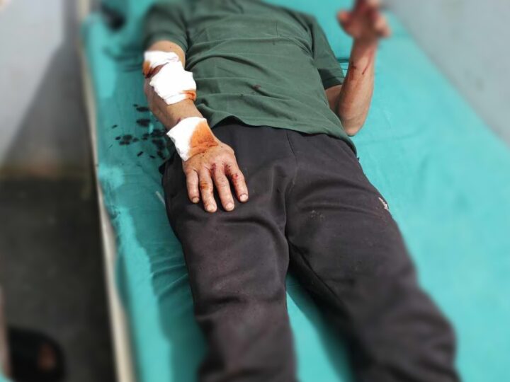 बाघको आक्रमण बाट म्याग्देका मनबहादुर घाइते