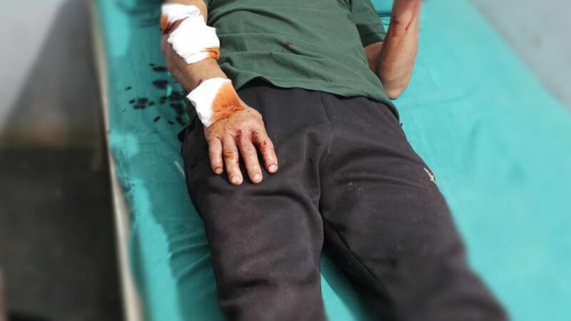 बाघको आक्रमण बाट म्याग्देका मनबहादुर घाइते