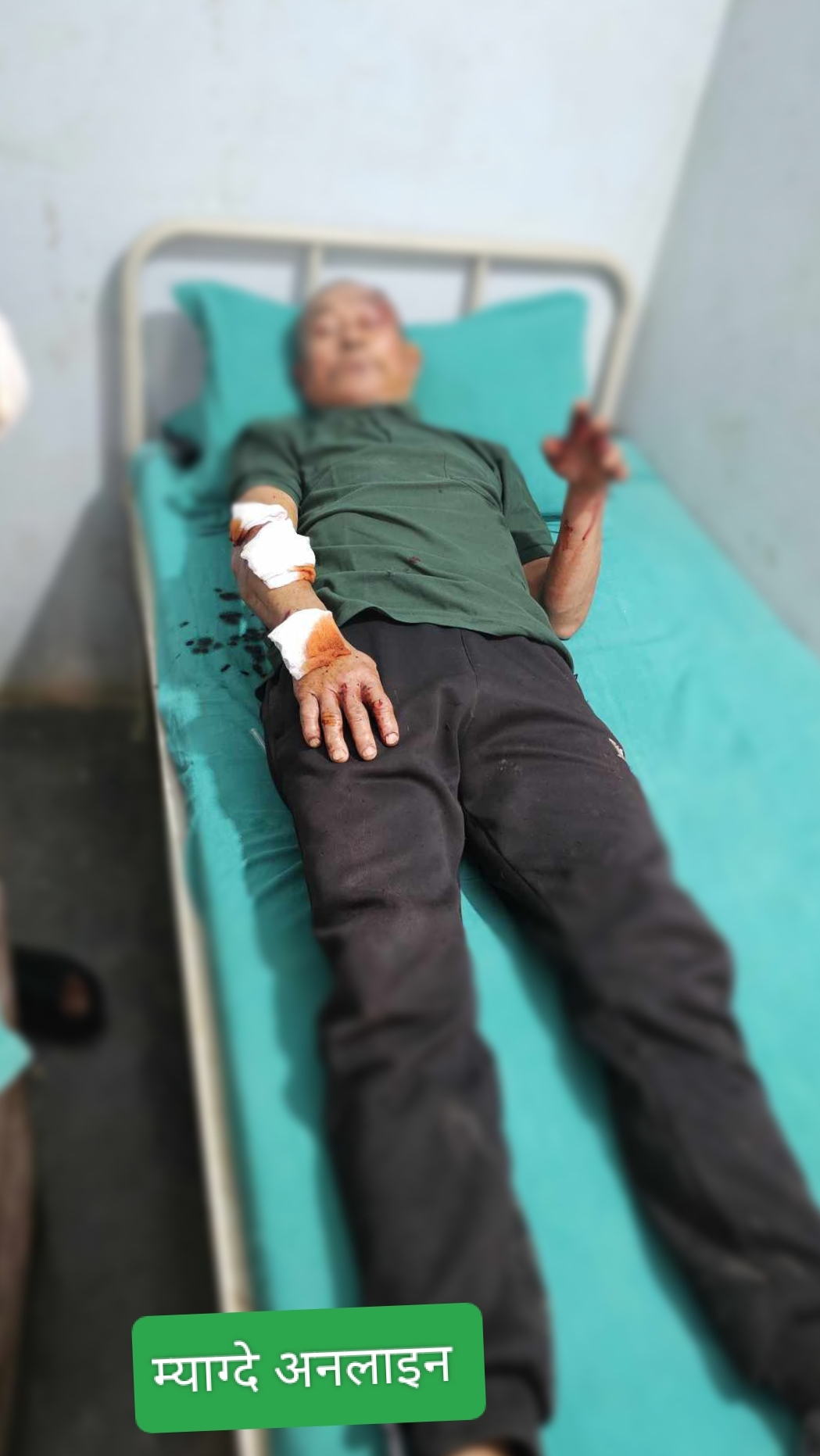 बाघको आक्रमण बाट म्याग्देका मनबहादुर घाइते