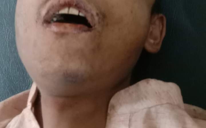 बेवारिसे मृतक युवाकाे आफन्त आए , नगरकोटका शेखर भएको पुष्टि