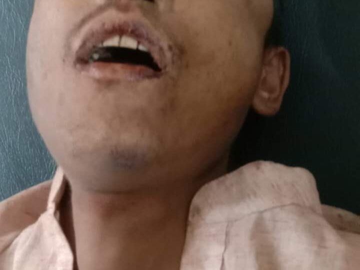 बेवारिसे बिरामी पुरूष दमाैली अस्पतालमा भर्ना , आफन्तकाे खाेजी