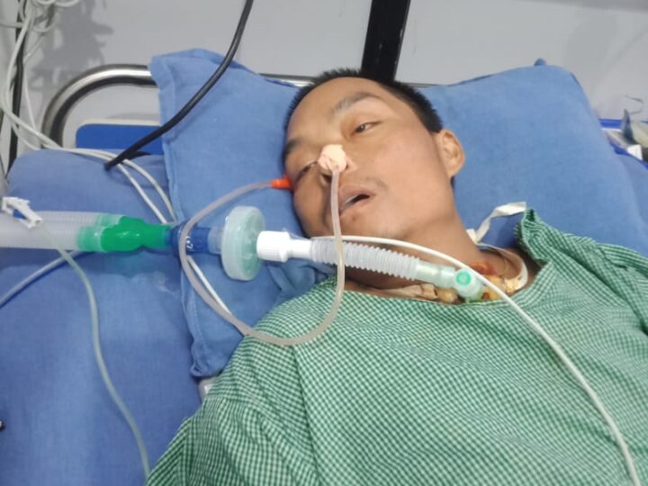 म्याग्देका आले गम्भीर बिरामी भइ १८ दिनदेखि अस्पतालकाे भेन्टिलेटरमा , सहयोगकाे अपिल