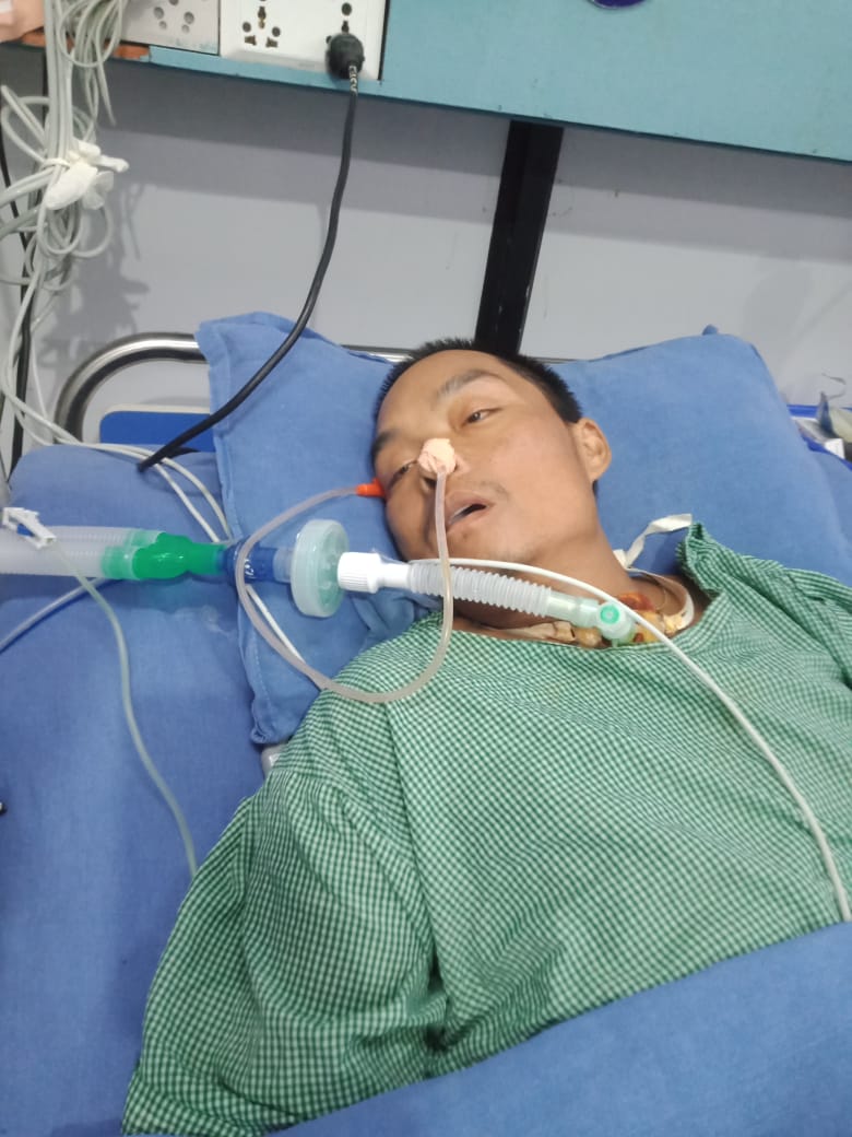 म्याग्देका आले गम्भीर बिरामी भइ १८ दिनदेखि अस्पतालकाे भेन्टिलेटरमा , सहयोगकाे अपिल