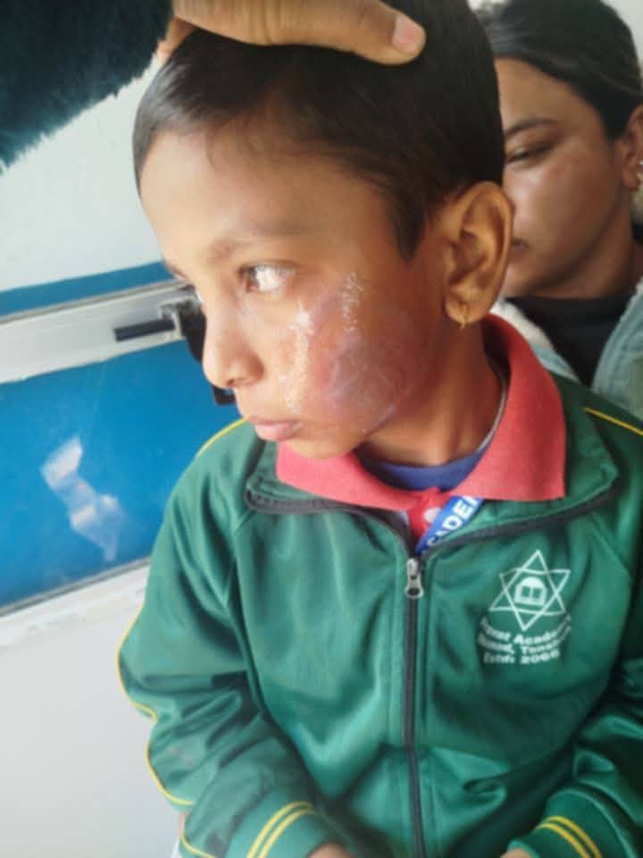 बच्चालाई पनियाेले डाम्ने मिस १ लाख २० हजार र पनियाे तताउने राना ६० हजार धराैटिमा रिहा