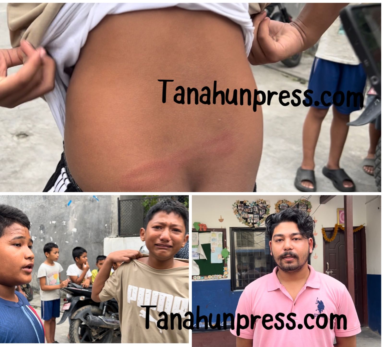 गाेरखकाली आवासीय मावि दमाैलीका शिक्षक अर्विनले बिद्यार्थीलाई पाइपले कुटे