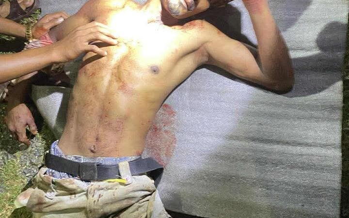 म्याग्देमा खुडा प्रहार काण्ड , घाइतेको अवस्था गम्भीर , जाहेरी दर्ता , ५ जना पक्राउ