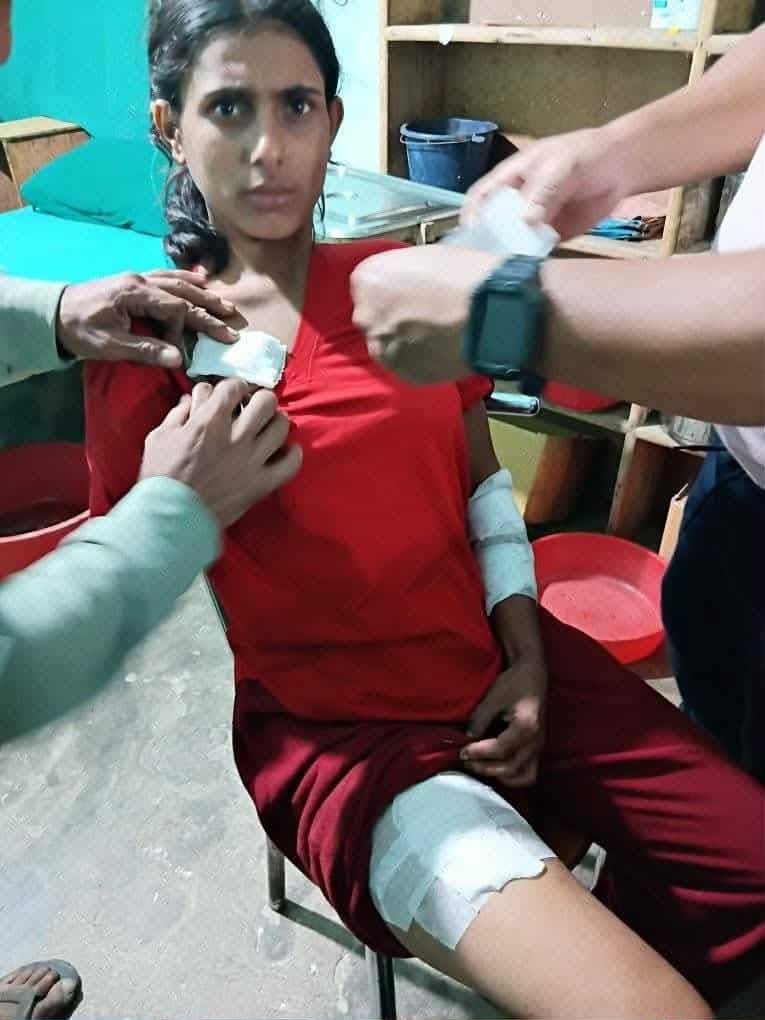 चितुवाको आक्रमणबाट बाहुनपाेखरामा २२ बर्षीय पौडेल घाइते